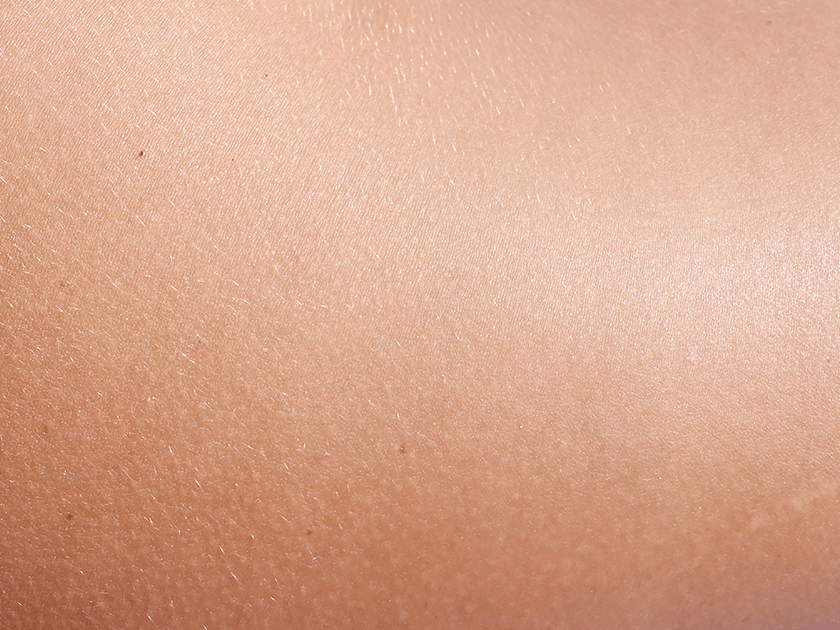 Close-up of human skin texture