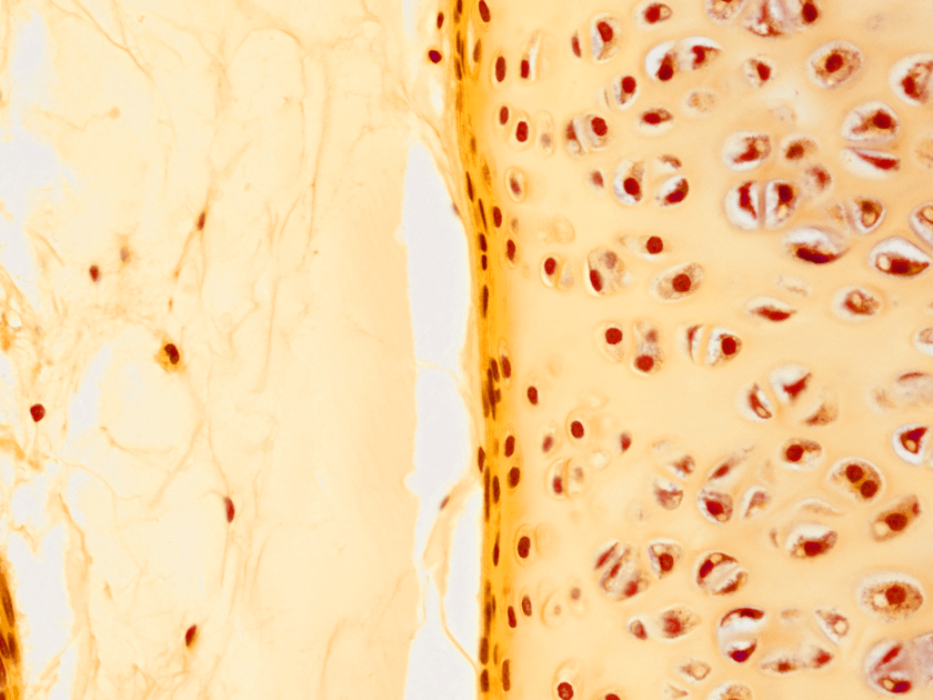 Close-up of textured yellow surface with holes and patterns